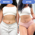 SONIQ - Ultrasoniq Body Toner & Cellulite Remover